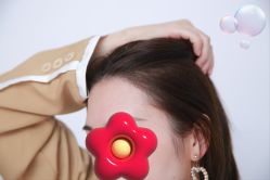 -大麦微针植发丨全国连锁