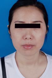 点击看大图 -SKINIST丽铂医疗美容