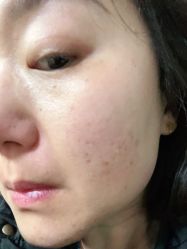 -痣清宫祛斑祛痣连锁店