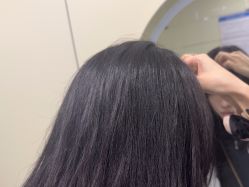 -碧莲盛·不剃发植发