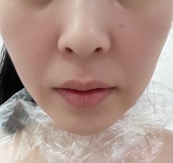 -海涛医疗美容·面部抗衰·注射美鼻