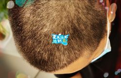 -大麦微针植发全国连锁