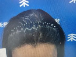 -雍禾植发全国连锁