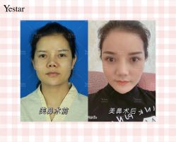 -Yestar艺星医疗美容医院