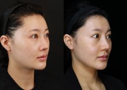 -韩辰医疗整形美容医院