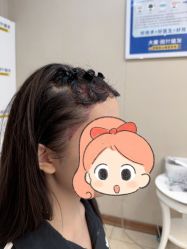 -大麦微针植发全国连锁