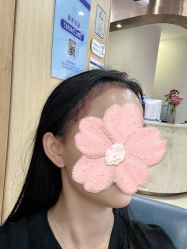 点击看大图 -大麦微针植发全国连锁
