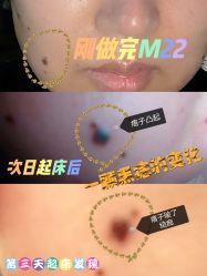 -圣嘉新医疗美容医院