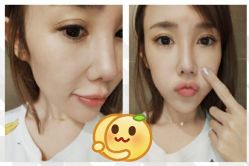 -SKINIST丽铂医疗美容
