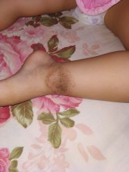 -丽美妍医疗美容·皮秒·立体分层抗衰