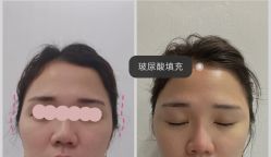 -上海漾颜医疗美容