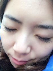 iphone_upload_pic-依萱绮医疗美容