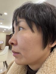 -长沙雅美医疗美容医院