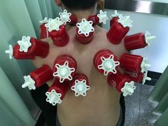 -孟氏拔罐(纬一路店)