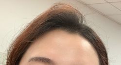 体验前-上海玫瑰医疗美容医院