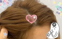 -大麦微针植发全国连锁