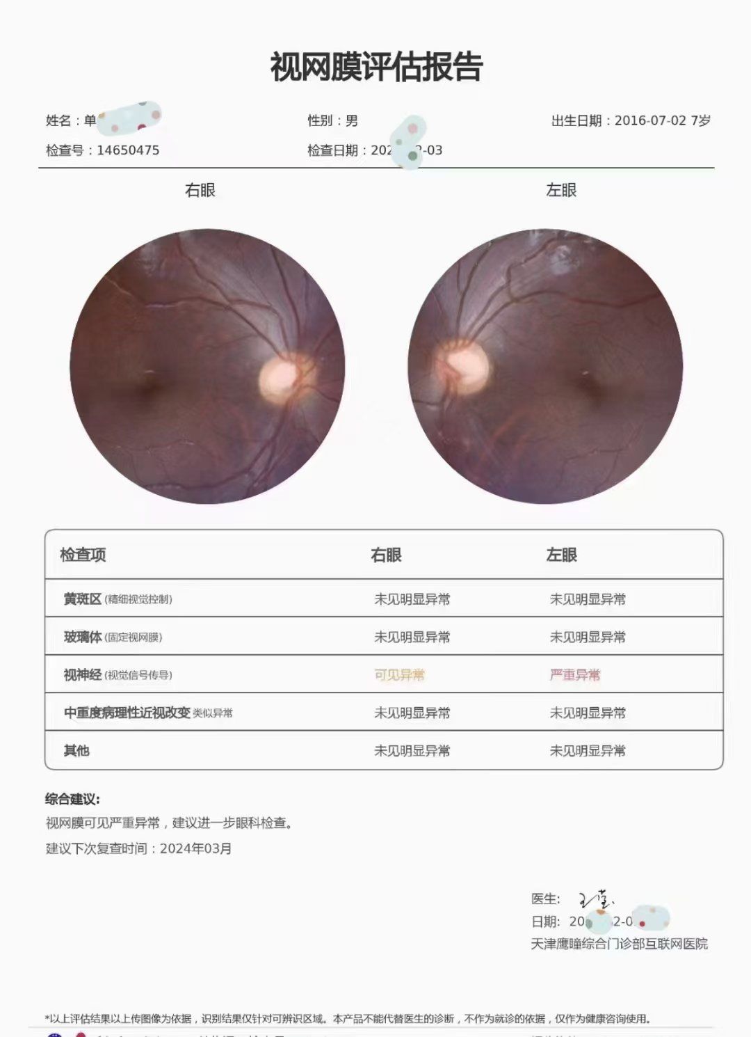检查眼底的重要性