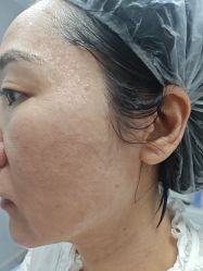 -长沙雅美医疗美容医院