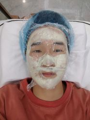 -悟空祛痘·诺奖技术专业店