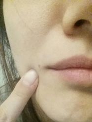 -新美荟医美·专注面部美学抗衰