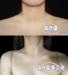 -肌密·水光·祛痘·黄金微针
