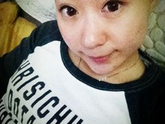 第十四天-上海华安整形外科门诊部