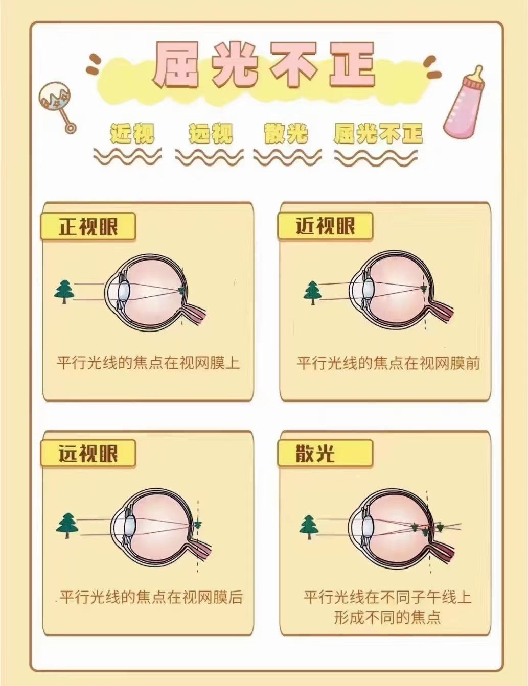 什么是屈光不正?
