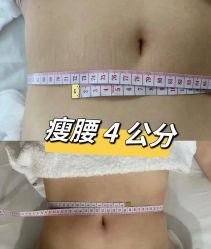 -Lily纤美·科技减脂中心