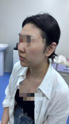 -海涛医疗美容·面部抗衰·注射美鼻