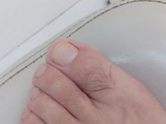 -新甲连锁灰指甲·甲沟炎·鸡眼(黑龙江路店)