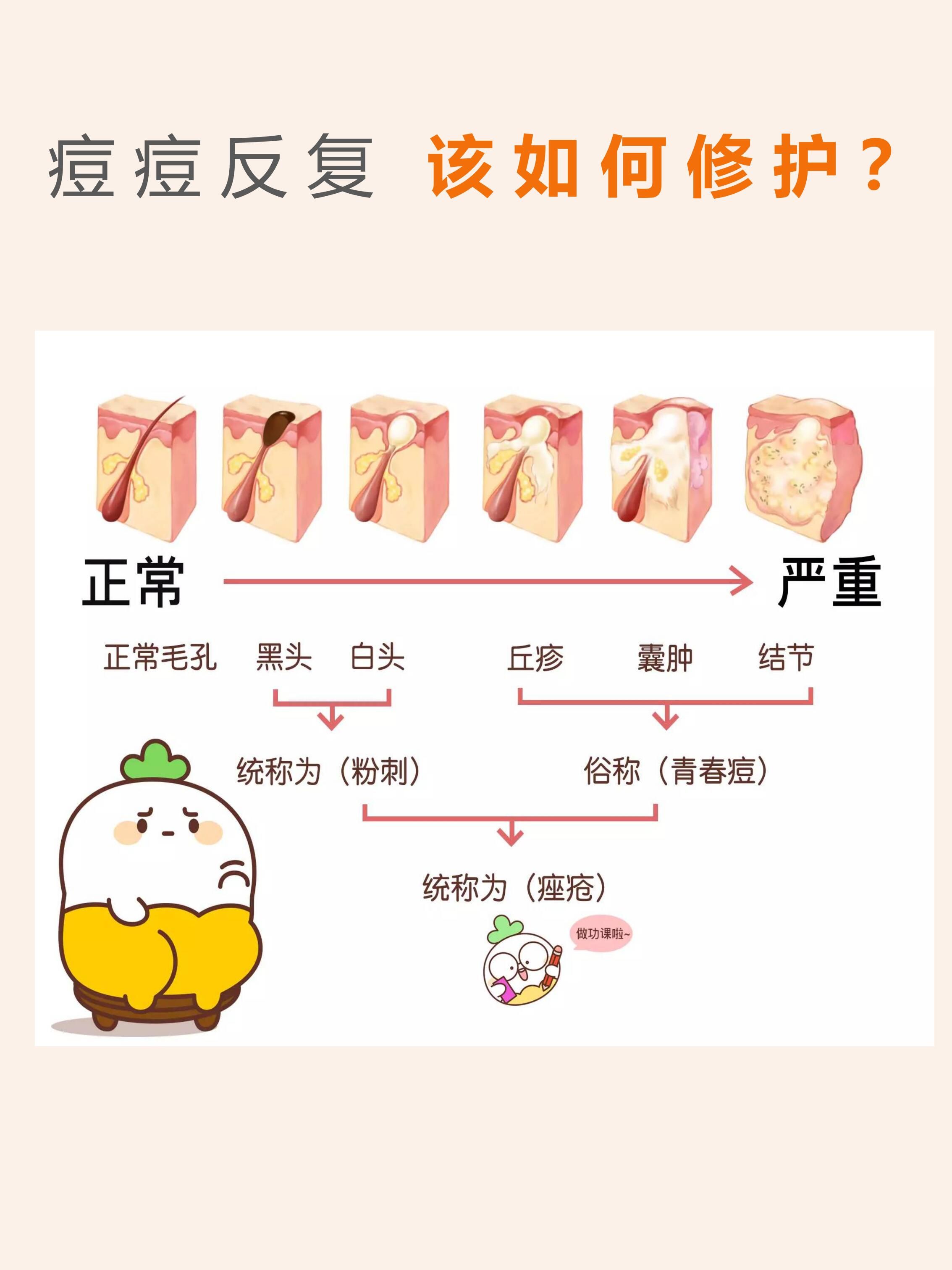 来大姨妈之前脸上为什么会长痘痘为什么在线