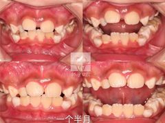 -Dr.Z dental仁康种植矫正中心