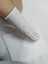 点击看大图 体验后-荟草堂专业祛痘修护中心