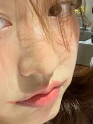 体验前-上海玫瑰医疗美容医院