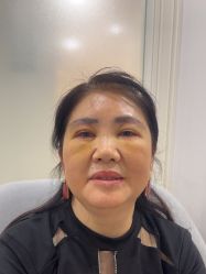 -万州华美紫馨整形美容医院