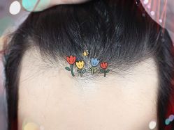 -大麦微针植发全国连锁