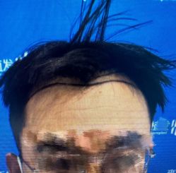 -雍禾植发全国连锁