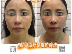 -修申骨雕小颜脊柱骨盆管理产后修复