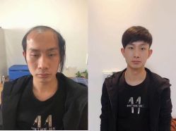 -发饰美男士增发补发假发定制店