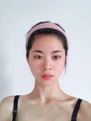 点击看大图 体验前-广东韩妃整形外科医院
