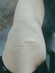 -成都军建医院·疤痕诊疗中心