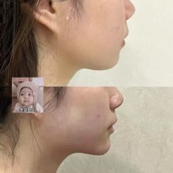 -东莞西妃整形美容医院