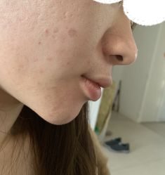 -苗方清颜痘肌研究所