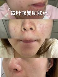 -彼家美创·量肤定制修护管理