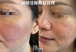 -栖SPA·ONDA ·海菲秀·皑皑科技美肤中心