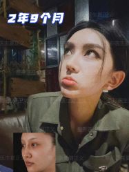 -北京米扬丽格医疗美容·联合丽格鼻整形中心