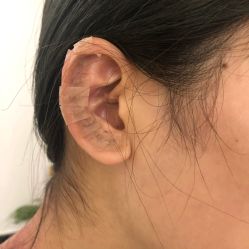 -溢美古法抗衰