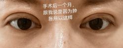 体验后-海峡医疗美容医院