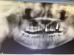 -泰康拜博口腔(柠溪门诊)