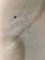 -OAE日式皮肤管理お肌の